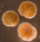 Alive foraminifera from Skagerrak's sea floor.